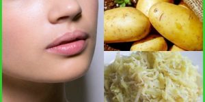 beneficios da batata para pele