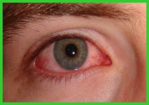 Cegueira noturna: o que é, causas, sintomas e como prevenir - Dicas de ...