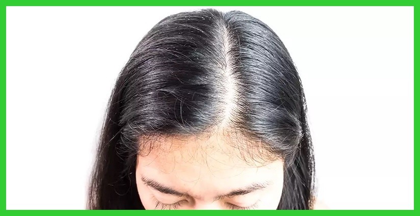 porque o cabelo para de crescer